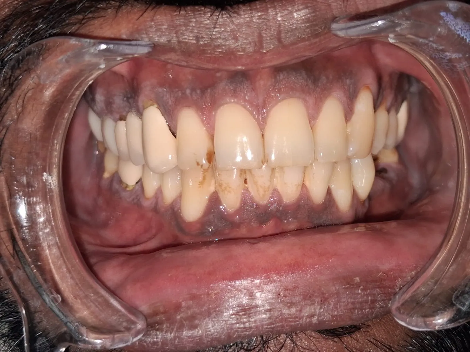 Sudheer Verma Before