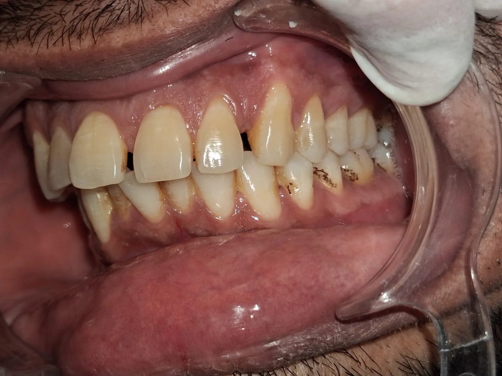 Vishal Reddy Before View 2